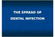 The Spread of Dental Infection (1)