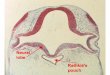MOUTH AND TONGUE 01 FOREBRAIN CROSS SECTION: Identify RATHKIE'S POUCH AND EVAGINATION OF NEURAL LOBE OF HYPOPHYSIS