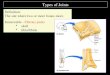 Types of Joints Definition: The site where two or more bones meet. Immovable - Fibrous joints skull tibia/fibula