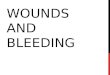WOUNDS AND BLEEDING. CLASSIFICATION Wounds are classified into two large groups - open wound - closed wound