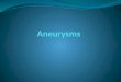 What is an aneurysm?? An aneurysm is a localized, permanent dilatation of an artery greater than 1.5 times its normal diameter. Aneurysms occur all over