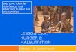 LESSON 13.4: HUNGER & MALNUTRITION Module 13: Global Health Obj. 13.4: Identify risk factors and effects of hunger and malnutrition