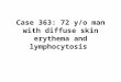 Case 363: 72 y/o man with diffuse skin erythema and lymphocytosis