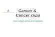 Cancer & Cancer clips how cancer grows and spreads how cancer grows and spreads