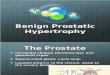 Benign prostate hypertrophy