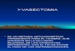 vasectomia ppt