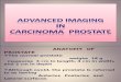 Imaging in Prostate