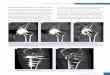 GEHealthcare-Publication Clinical Value Musculoskeletal Imaging Nov 2011