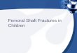 Femoral Shaft Fractures in Children Journal