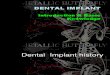 Implant Introduction & History -Simple Version