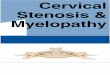 Cervical Myelopathy Guide