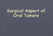 Surgical Aspect of Oral Tumors