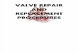 Valve Repair & Replacement