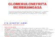 Glomerulonefrita membranoasa