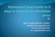 Permanent fixed teeth within 5 days in Chennai at affordable price