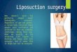 Liposuction surgery in Delhi