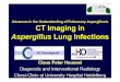 CT Imaging in Aspergillus Lung Infections
