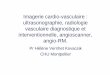 Imagerie cardio-vasculaire : ultrasonographie, radiologie vasculaire 