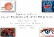 Ocular Melanoma and Liver Metastases