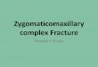Zygomaticomaxillary complex fracture