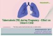 Tuberculosis during pregnancy