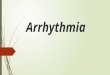 Arrhythmia - Pathophysiology and Treatment (Pharmacotherapy)