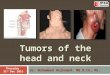 02 msu tumors of head and neck hajhamad m