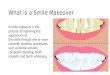 What is a smile makeover