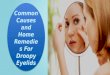 Causes and home remedies for droopy eyelids