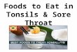 Foods to Eat & Avoid in Tonsils & Sore Throat in Hindi Iटॉन्सिल्स और सोर थ्रोट में क्या खाए और क्या न खाएI