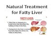 Natural Treatment for Fatty Liver in Hindi Iफैटी लीवर के लिए प्राकृतिक उपचारI