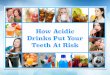 Cardiff Dentist Tips: How Acidic Drinks Put Your Teeth At Risk