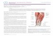 Radial Artery Cannulation: A Review Article