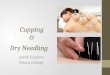 cupping & dry needling