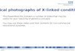 Clinical Photos - X-linked conditions
