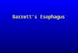 Barrett's esophagus; guidelines & new endoscopic techniques