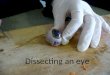 Dissecting An Eye2