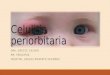 Celulitis periorbitaria