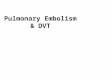 Deep Venous Thrombosis & Pulmonary Embolism
