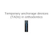 Temporary anchorage devices (ta ds) in orthodontics 4 present