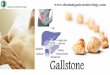 Gallstone Removal In Chennai | Laparoscopic Surgeon In India