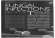 Fungal infections: a growing threat