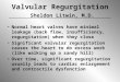 Mon 12-05-2005 OS Lecture 6 - Valve Disease Regurgitant - Dr 