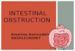 Mellss surgery y3 intestinal obstruction