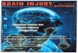 MRJ Brain Injury Team Article - Pitfalls of Oversimplified Headache Diagnosis in TBI Litigation