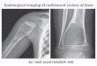 Presentation1.pptx, radiological imaging of rediolucent lesions of bones