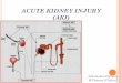 Acute kidney injury(AKI)