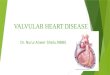Valvular heart disease final