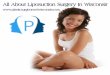 All You Wanted To Know About Liposuction Surgery In Wisconsin