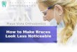 How To Make Braces Look Less Noticeable
